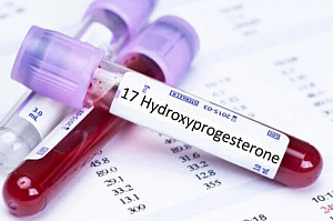 17-ОН гидроксипрогестерон