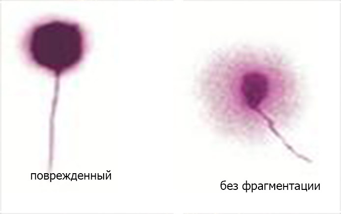 Определение фрагментации ДНК в сперматозоидах