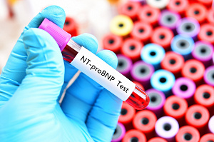 Скрининг сердечно-сосудистой патологии: тест NT-proBNP