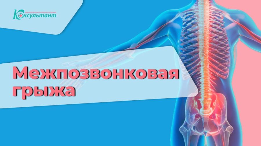 Межпозвонковая грыжа