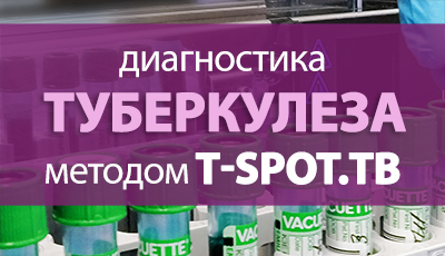 Иммунологическое исследование крови на микобактерии туберкулеза методом T-SPOT.TB