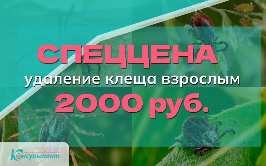 СПЕЦЦЕНА на удаление клеща взрослым – 2000 руб!