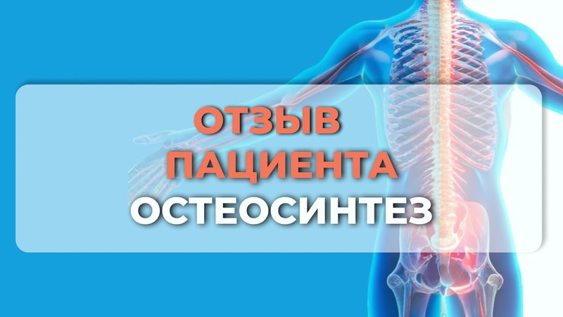 Отзыв пациента - Остеосинтез