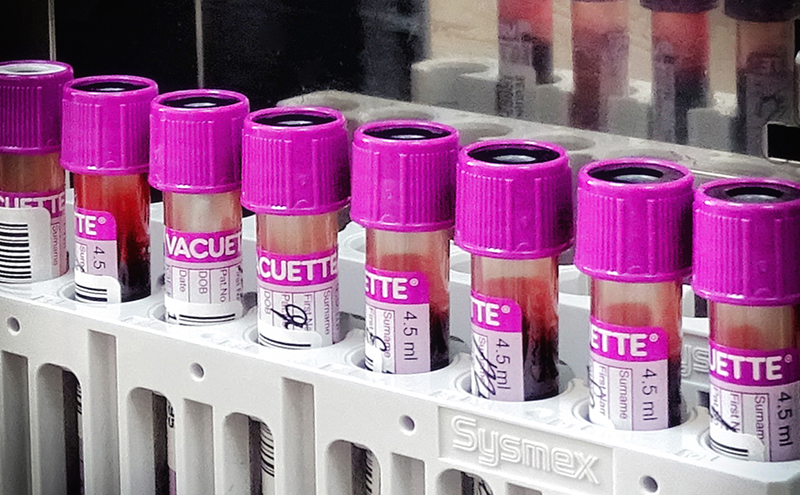 Ультрачувствительный тест на вирусы гепатитов В и С