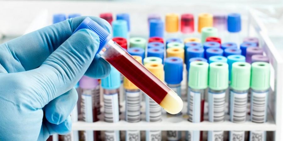 Лаборатория МЦ «Консультант» проводит определение Антимюллеровского гормона (АМГ) в крови