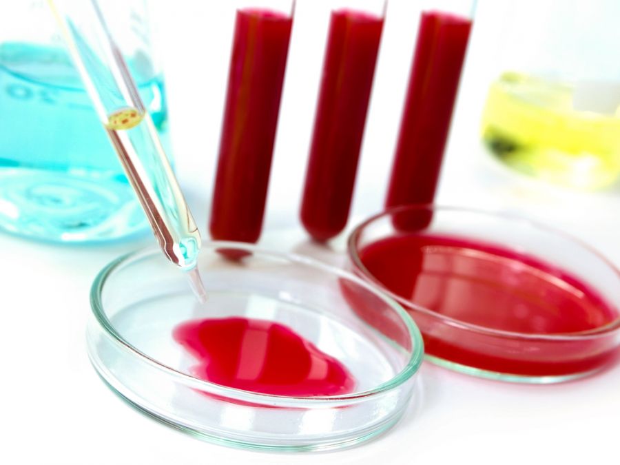 Лаборатория МЦ «Консультант» проводит определение витамина Д в крови 